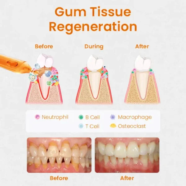 Gum Repair Treatment Ampoules Tooth Serum